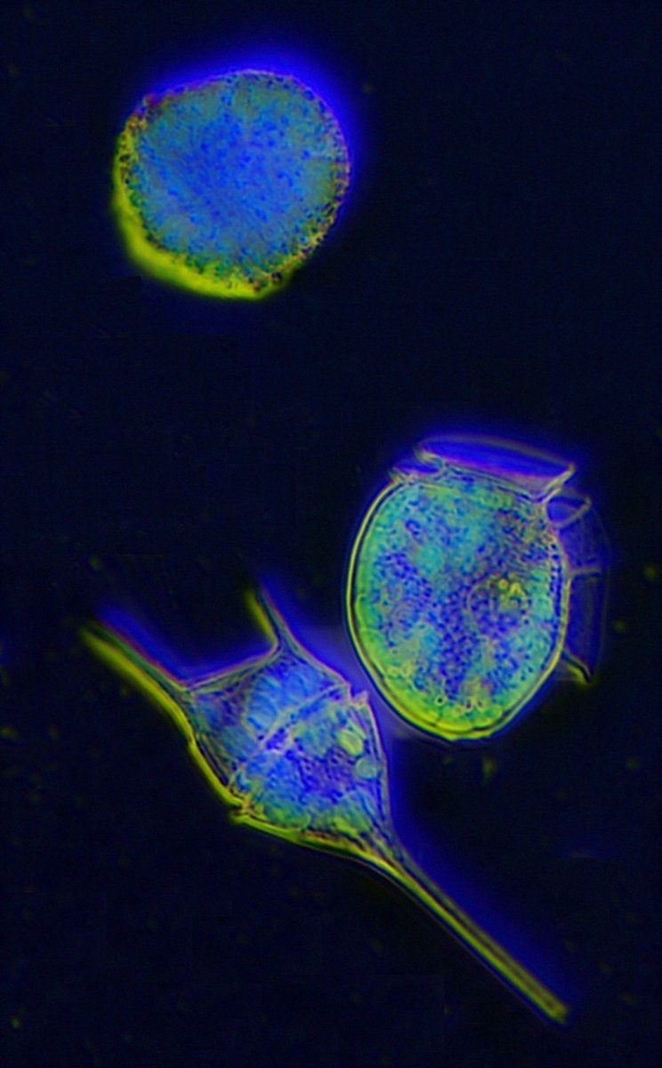 plancton_andino's tweet photo. Nice image of 3 dinoflagellates species. using invert and background subtraction command with imageJ #ADICFITO PROJECT #POAS #DINOS #PSMB #AQUA #FANINDEX #FAN #HAB #FJORD https://t.co/GCtDkeoBrC