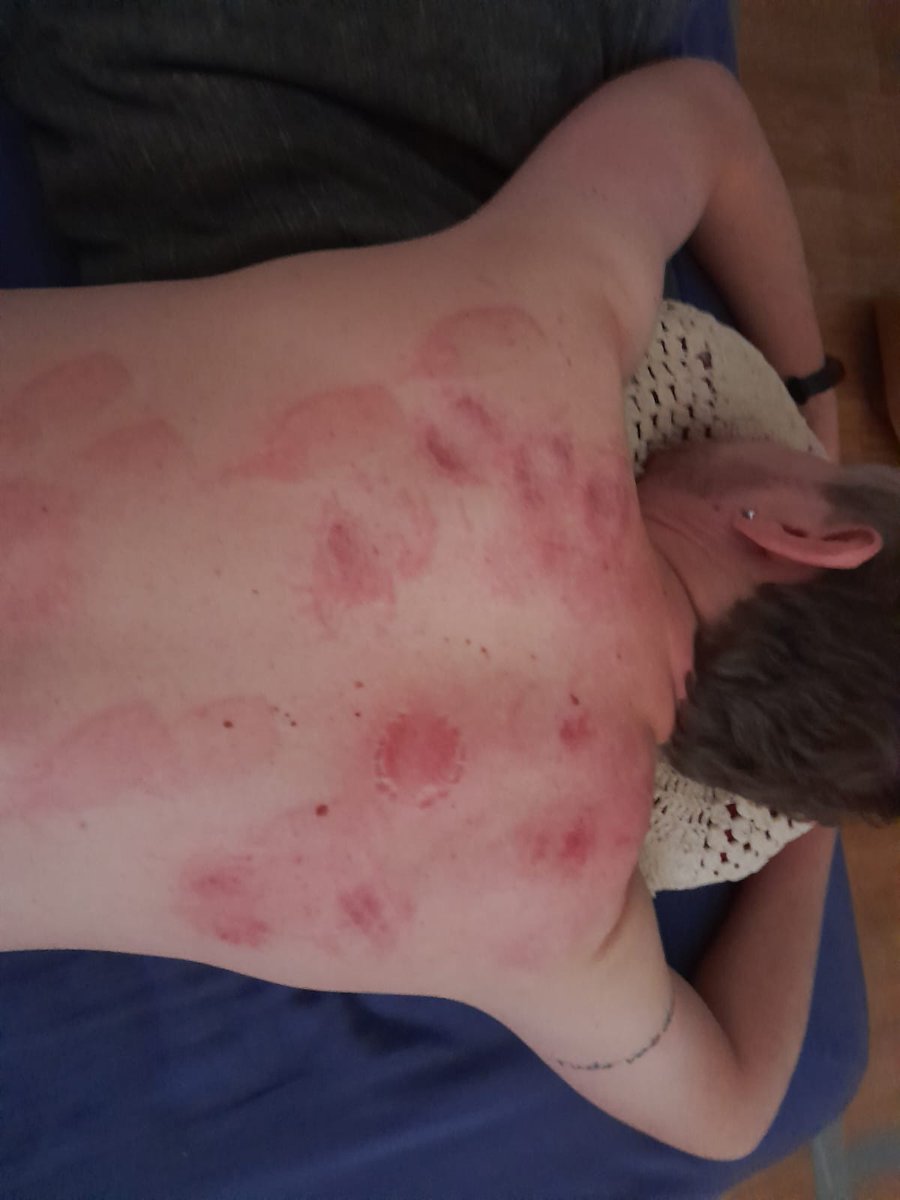 Quando o cara gosta de morder, eu deixo 😈