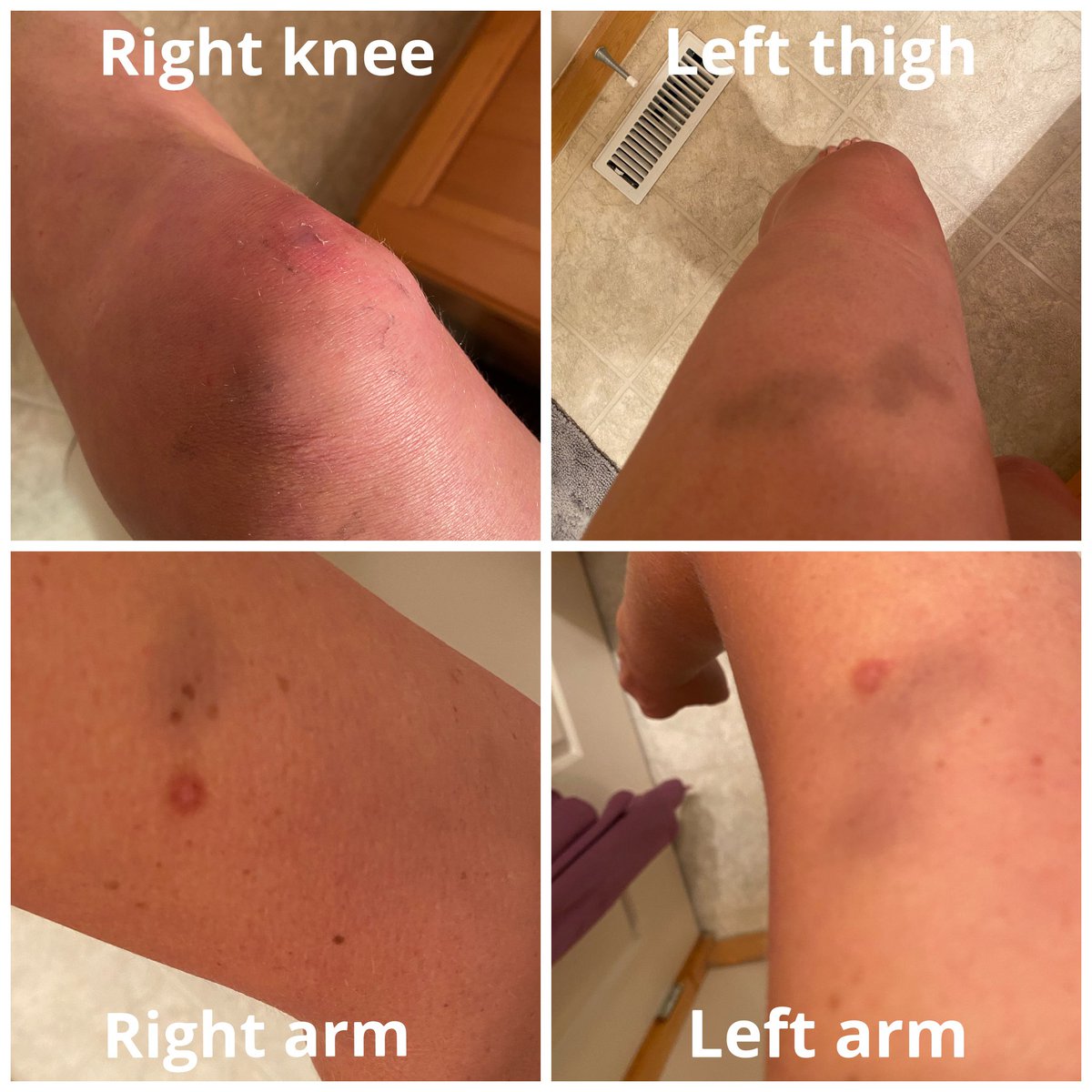 Mommy Has Cancer (she/her/elle/ella) tweet media