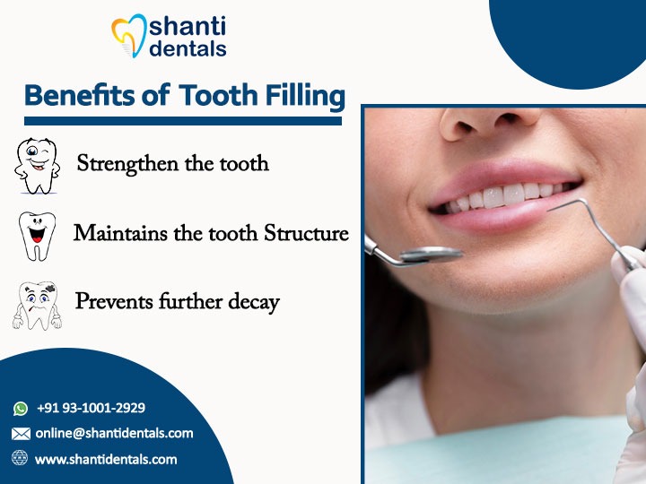 shantidentals's tweet photo. A filling is used to treat a #smallhole or #cavity in a #tooth To repair a cavity, Our #dentist removes the #decayedtoothtissue and then fills the #space with a #fillingmaterial Visit Us:  https://t.co/ojezmySS2T

#tooth #teeth #toothstructure #decay #decayteeth #decaytooth #Rct https://t.co/KFVvCpVKLv