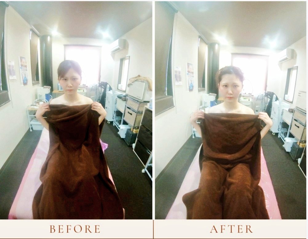 昨日は独立した友達のとこに遊びに行きました🎶小顔リンパをしてあげましたが、顔のみでも効果は即実感できますが、首肩オイルするのとしないとでは効果の違いが凄く出るなと感じました(^^)写真のお客様は若く顔も色白で小顔ですが更にトーンアップ・リフトアップ・全体的にシュッとなりました😊
#小顔