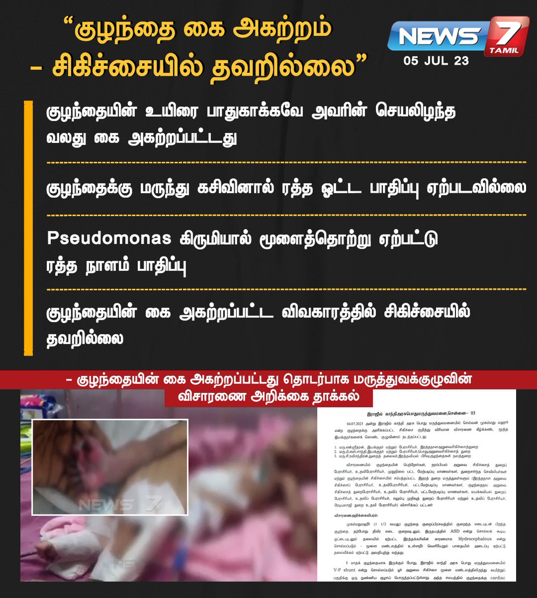 news7tamil's tweet photo. ”குழந்தை கை அகற்றம் - சிகிச்சையில் தவறில்லை”
#RajivGandhiHospital | #ChildHandIssue | #Health | #Treatment | #Statement | #News7Tamil | #News7TamilUpdates https://t.co/7dx8wX3cqM