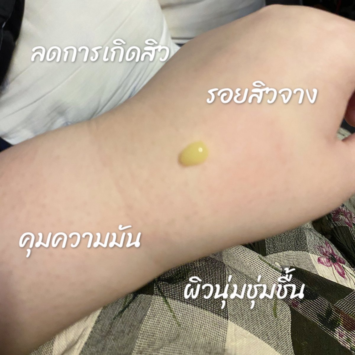 KT_ChoL's tweet photo. ปกติประจำเดือนมาแต่ละทีคือปวดหัวกับสิวและรอยสิวหนักมาก ตัวช่วยที่รักษาทั้งสิวและรอยก็คือหายากมากแม่ แต่ตอนนี้เจอแล้วจ้า กรี๊ดดังๆสามทีให้ #EucerinProAcne Anti acne mark 🥰 นอกจากช่วยรักษาสิว ลดการอุดตัน รอยสิวเก่าจาง แล้วยังช่วยคุมความมันให้อีก ไปตำเถอะ คุ้มแน่นอน #ใช้ดีบอกต่อ https://t.co/gYxxyVAo98