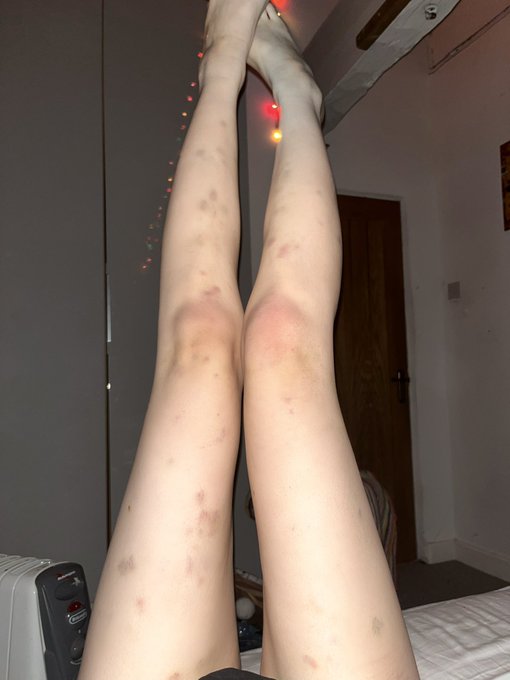 low iron be like: https://t.co/mojOQnsfzw