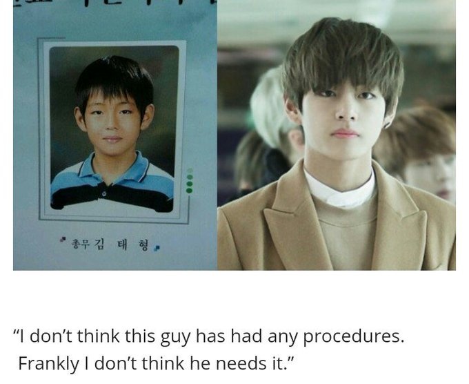 taehyung is aging bckwrd he still tht fetus tae nothing has chngd
and a remder that mltple plstc surgeons praises his face and 1 of em evn sd 'bts V's handsome face for his golden ratio & natural features that's hard to replicate wth surgery' he's the definition of born beautiful