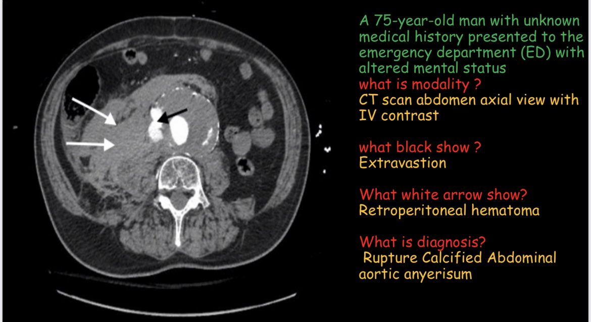 HamadeB's tweet photo. ختام دورات. Opthalmology , Gynaecology and obstetrics,Radiology. علي منصه همزه  #دفعه 46🙏 https://t.co/545P1svi1T