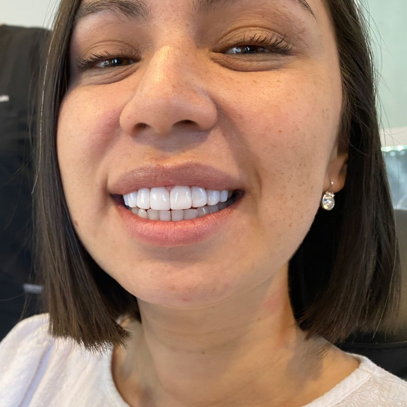 MyTrendingness's tweet photo. Here Is What You Should Actually Pay For Full Mouth Dental Implants In 2023.

Prices May Really Surprise You!

Take a look at the site below and find all the details 👇