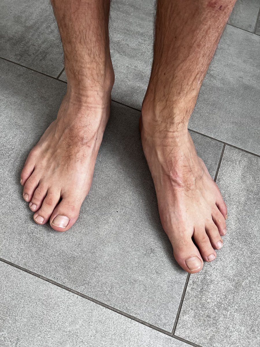 DanOCon70947195's tweet photo. #fussfetisch #fussfetish #feet #feetpic #feetmodels #feettweet #feetfetishgang #malefeet #malefeetmodel #malefeetlove #malefeetslave #menfeet #menfeetfetish #feetlover #feetmodels #feetpic #feetpicswanted #feetjob #feetnails #cutefeet #ilovemyfeet #cleanfeet #dirtyfeet https://t.co/Tkb4y8EdnG