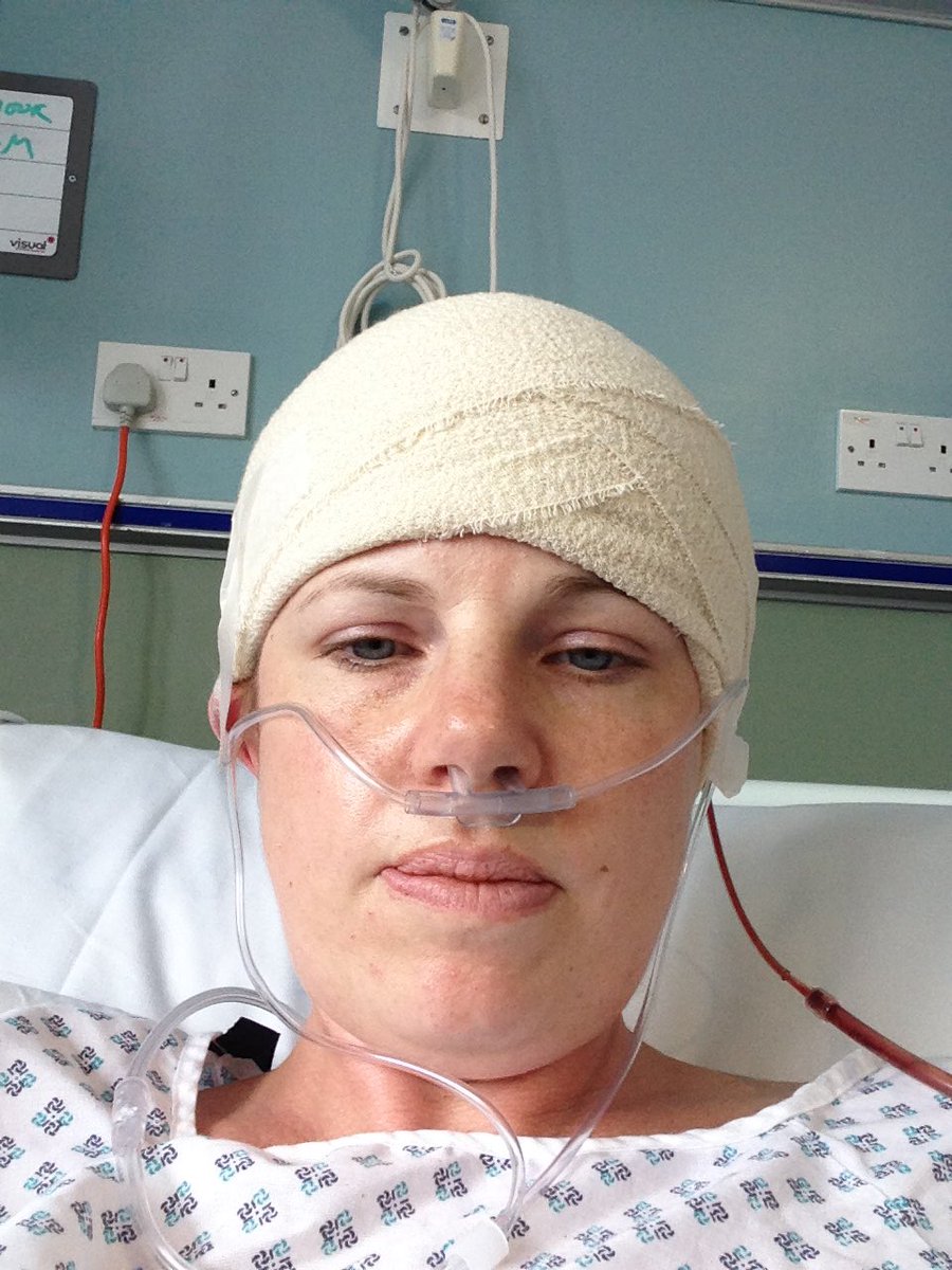 Leasey79's tweet photo. A personal thank you to the NHS as without them I wouldn’t be here today. Looking forward to joining the team and helping others when I qualify from @SunderlandOT next year as an OT #NHS75
#braintumorsurvivor #heretotellthetale https://t.co/sIP2anSGIN