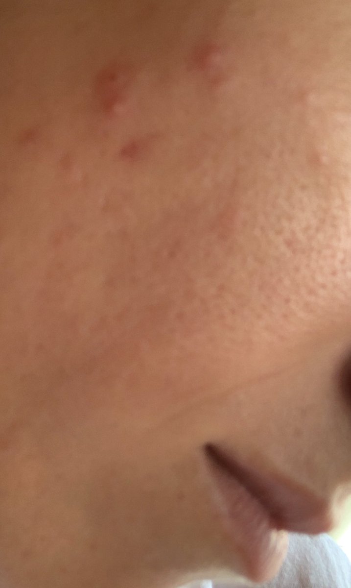 Cildim bu haftanın benim için önemli olduğunu anlamış