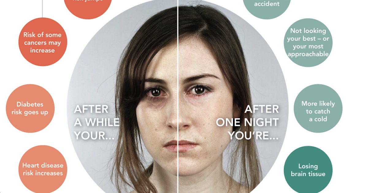 Can Chronic Sleep Deprivation Be Reversed Can Chronic Sleep Deprivation Be Reversed