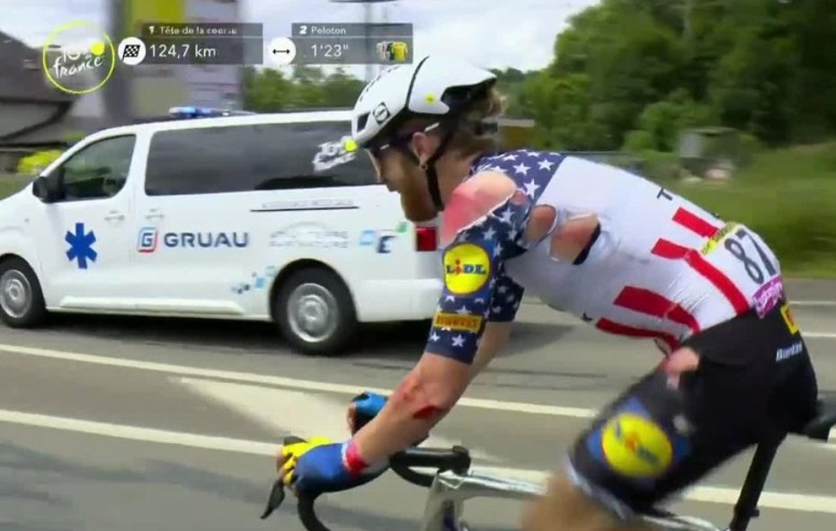 Scars &amp; Stripes 

@squin_simm #TourDeFrance #TDF2023 #TDF