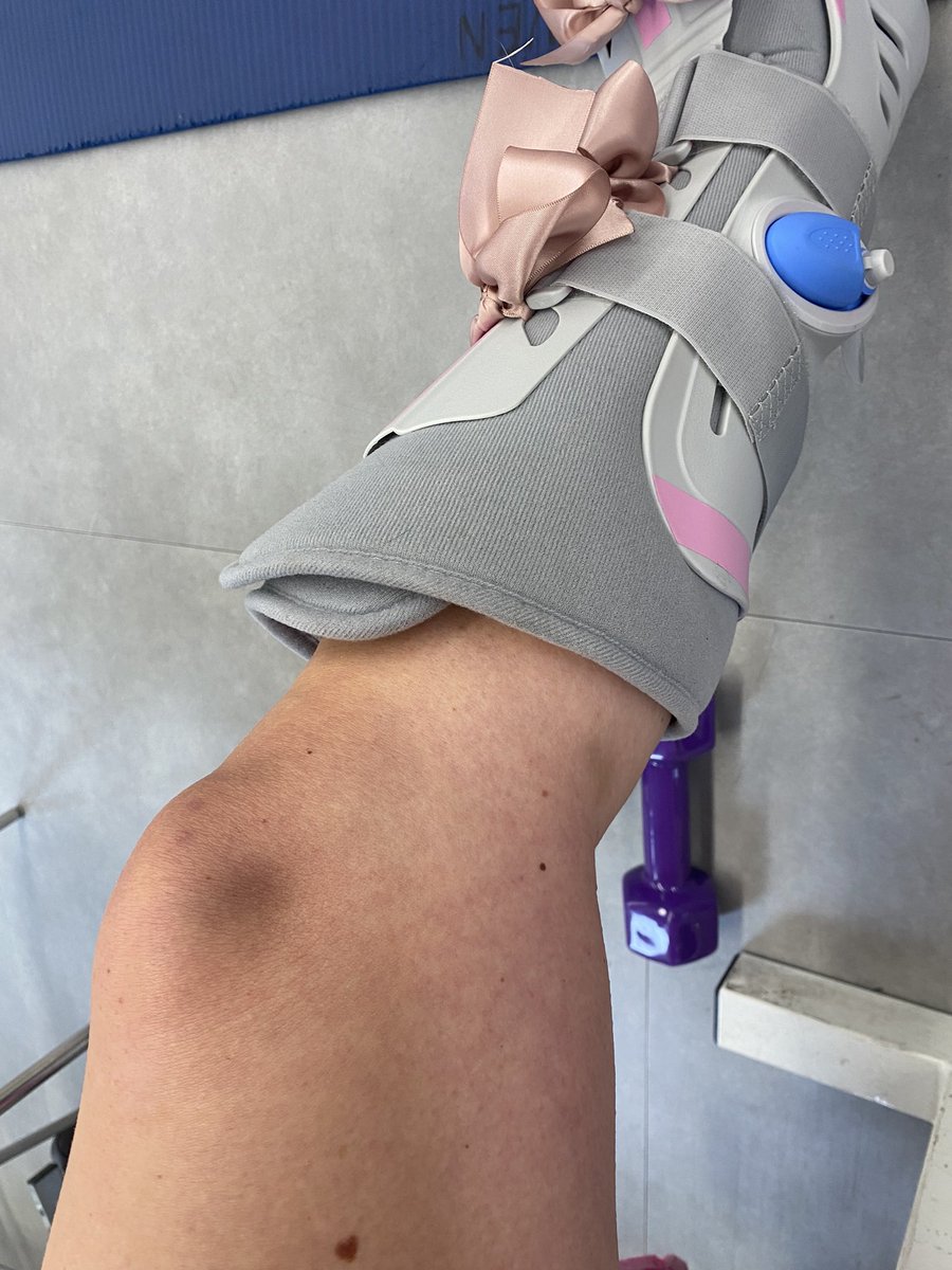 Turning into something of a leopard with these mystery bruises