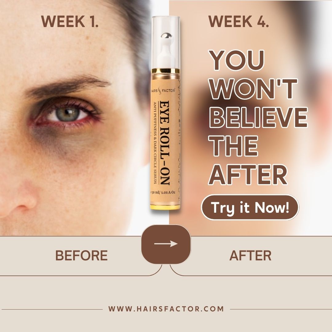 HairsFactor's tweet image. Unleash the Astonishing Transformation! Witness the Unbelievable 'After' Effect with our Revolutionary Eye Roll-On Serum. Behold the Dramatic Before-and-After Results and Experience the Magic Now!

#TransformationMagic #EyeRollOnSerum #BeforeAndAfterResults #UnbelievableTransform