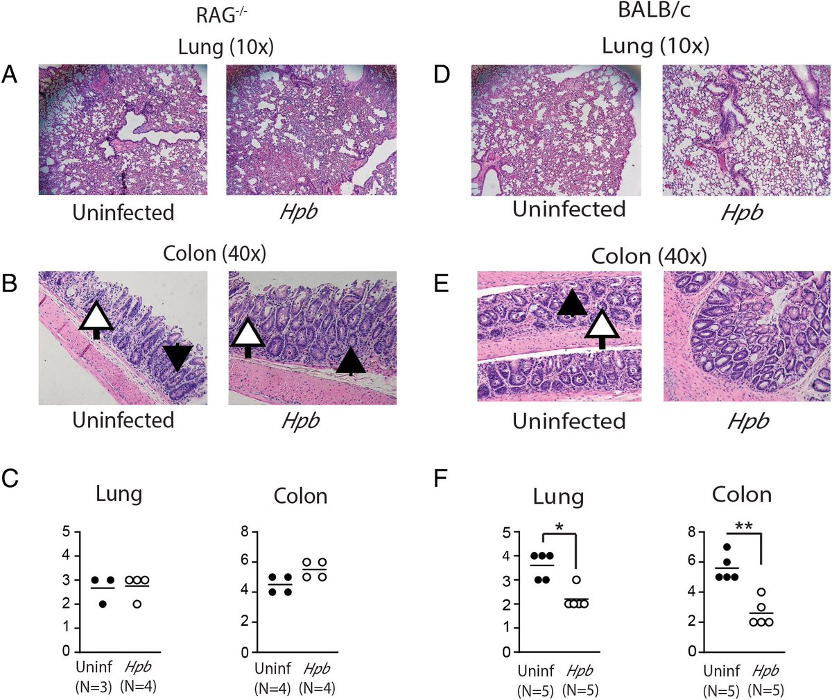 ImmunoHorizons's tweet photo. #NewinIH from @mirac_nedim @IowaMed:
Survival of immune-conditioned recipient #Tcells after #helminthinfection, and regulation of #GraftVersusHostDisease depends on Th2 signaling
#ReadIH #TransplantationImmunology @ImmunologyAAI #societypublisher π https://t.co/QztXZ0nG9k https://t.co/DvbtzIZuzL