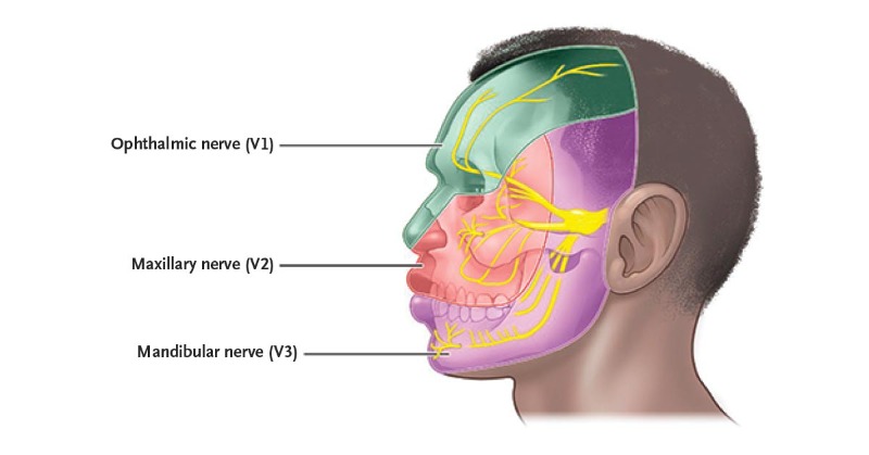 Mandibular Nerve (V3)