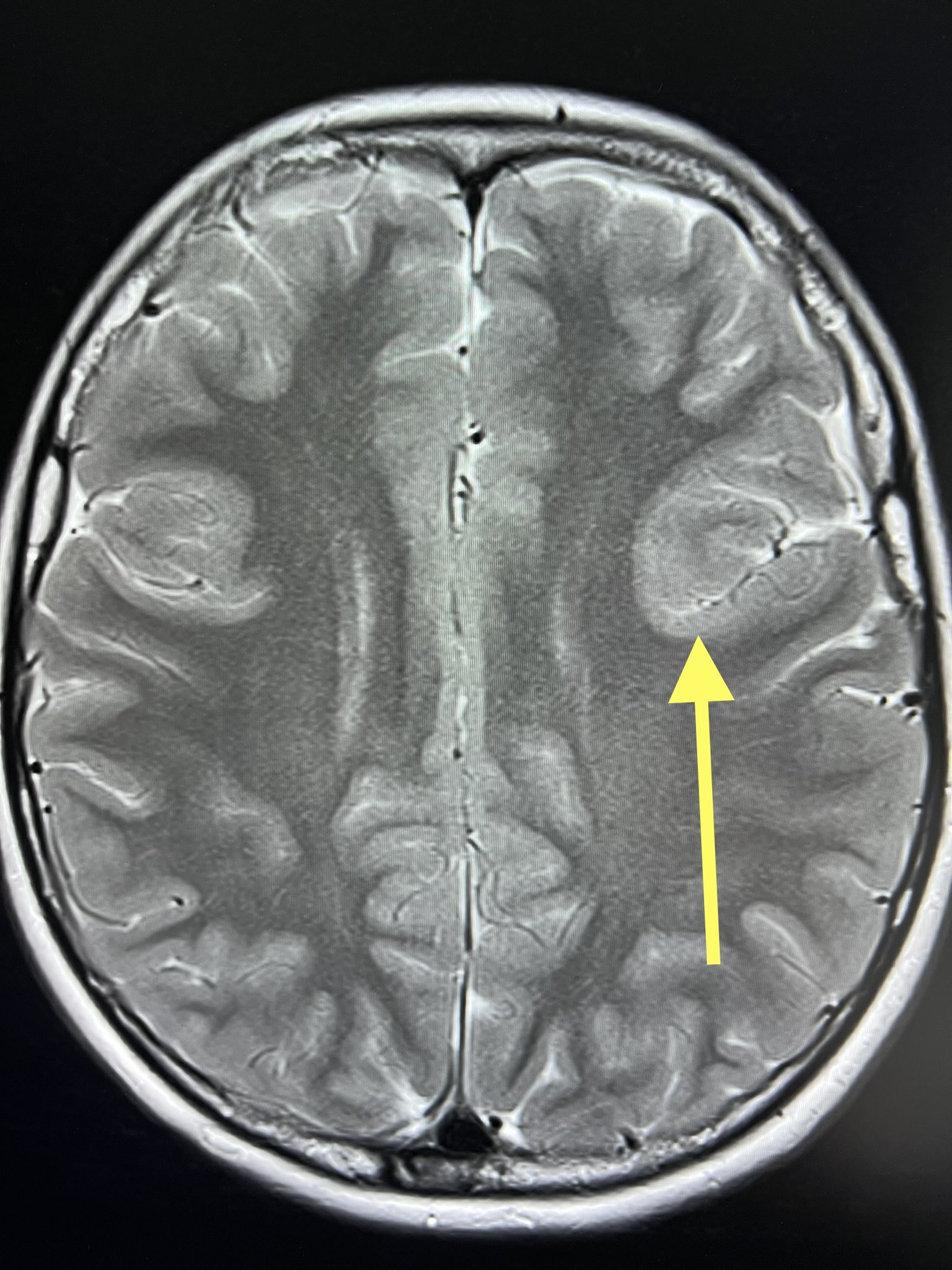 Dr Kish Mankad on Twitter "Tip of the day 💡 The dangers of “fast
