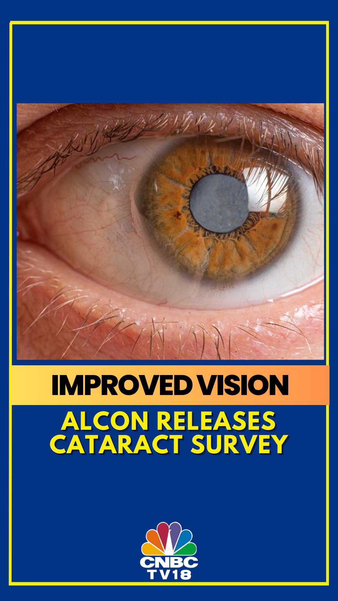 CNBCTV18 on Twitter "Pharma company Alcon's cataract survey shows wearing glasses makes 54