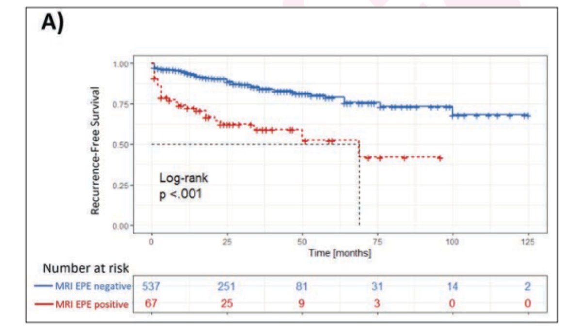 Andrew Rosenkrantz (@arosenkrantzmd) on Twitter photo New <a href="/AJR_Radiology/">AJR</a> Accepted Manuscript:
"Comparison of MRI-Based Staging and Pathologic Staging for Predicting Biochemical Recurrence of Prostate Cancer After Radical Prostatectomy"
By Drs Merriman, <a href="/PeterPintoMD/">Peter Pinto</a>, <a href="/radiolobt/">Baris Turkbey MD</a> & team @NCICCR_MIP
ajronline.org/doi/10.2214/AJ… New <a href="/AJR_Radiology/">AJR</a> Accepted Manuscript:
"Comparison of MRI-Based Staging and Pathologic Staging for Predicting Biochemical Recurrence of Prostate Cancer After Radical Prostatectomy"
By Drs Merriman, <a href="/PeterPintoMD/">Peter Pinto</a>, <a href="/radiolobt/">Baris Turkbey MD</a> & team @NCICCR_MIP
ajronline.org/doi/10.2214/AJ…