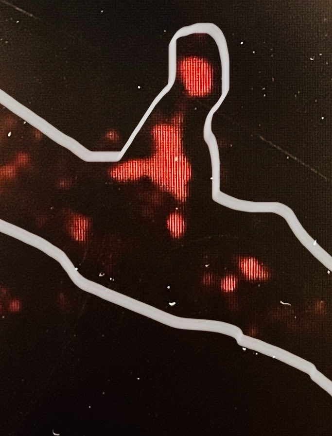 Our first DNA-PAINTed synapse using a newly installed @abbelight #superresolution microscope has two post-synaptic densities! @dandrite #newLab