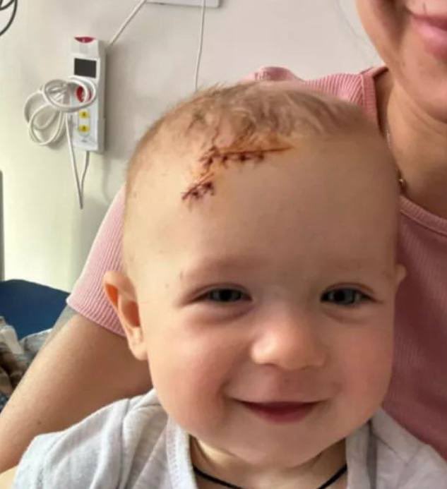 This little girl was injured during the terrorist attack on Kramatorsk. She had a successfull operation in Kyiv and is recovering fine.