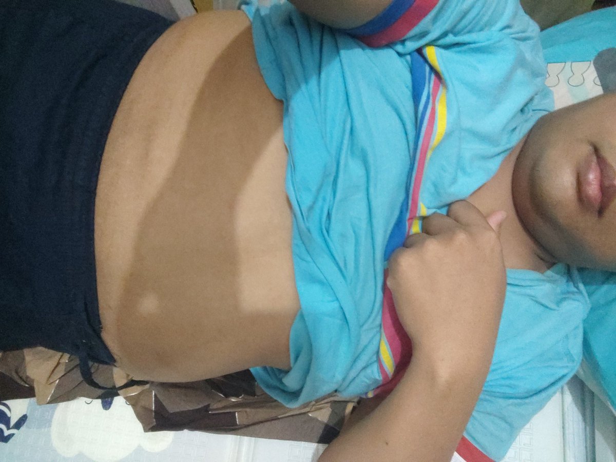 MuzaStory's tweet photo. @kikysaputrii kalo aku bukan gelambir lagi kak, melembung iya 😂🤣😂🤣😂🤣
tapi tetep PD karena aku masih diberi kesehatan (ya menuju sakit sih) karena obesitas sumber penyakit https://t.co/JIpc5A7liJ