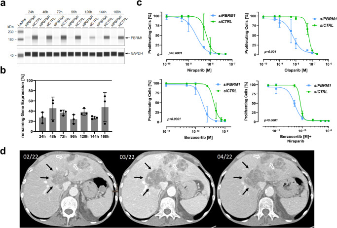 Emil Lou, MD, PhD, FACP (@cancerassassin1) on Twitter photo Now online in <a href="/Nature_NPJ/">npj Journals</a>: "PBRM1 mutations might render a subtype of biliary tract cancers sensitive to drugs targeting the DNA damage repair system." From the team of Dr. Andreas Seeber @imed_tweets and <a href="/carisls/">Caris Life Sciences</a> GI Onc Precision Oncology Alliance collaboration. Now online in <a href="/Nature_NPJ/">npj Journals</a>: "PBRM1 mutations might render a subtype of biliary tract cancers sensitive to drugs targeting the DNA damage repair system." From the team of Dr. Andreas Seeber @imed_tweets and <a href="/carisls/">Caris Life Sciences</a> GI Onc Precision Oncology Alliance collaboration.