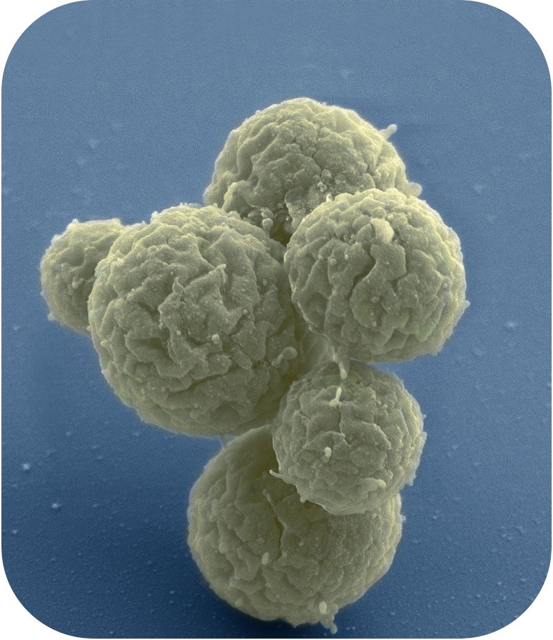 Jay T Lennon (@jaytlennon) on Twitter photo “Evolution of a minimal cell” in <a href="/Nature/">nature</a>:
nature.com/articles/s4158…
Led by <a href="/RoyBoy432/">R</a> with Brent Lehmkuhl at <a href="/IUBiology/">IU Biology</a>
<a href="/JCVenterInst/">J. Craig Venter Institute</a> collaborators: Lijie Sun, Daniela Bittencourt, Kim Wise, John Glass
Along with @dschoolmaster, and Mike Lynch <a href="/ASUBiodesign/">Biodesign Institute at Arizona State University</a> “Evolution of a minimal cell” in <a href="/Nature/">nature</a>:
nature.com/articles/s4158…
Led by <a href="/RoyBoy432/">R</a> with Brent Lehmkuhl at <a href="/IUBiology/">IU Biology</a>
<a href="/JCVenterInst/">J. Craig Venter Institute</a> collaborators: Lijie Sun, Daniela Bittencourt, Kim Wise, John Glass
Along with @dschoolmaster, and Mike Lynch <a href="/ASUBiodesign/">Biodesign Institute at Arizona State University</a>