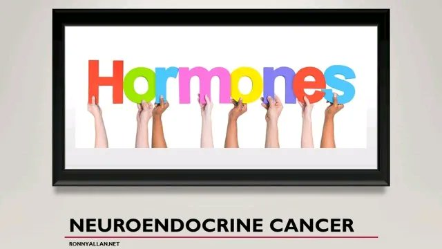 #NeuroendocrineCancer – Horrible Hormones - via <a href="/RonnyAllan1/">Ronny Allan</a> buff.ly/2Le8JiI