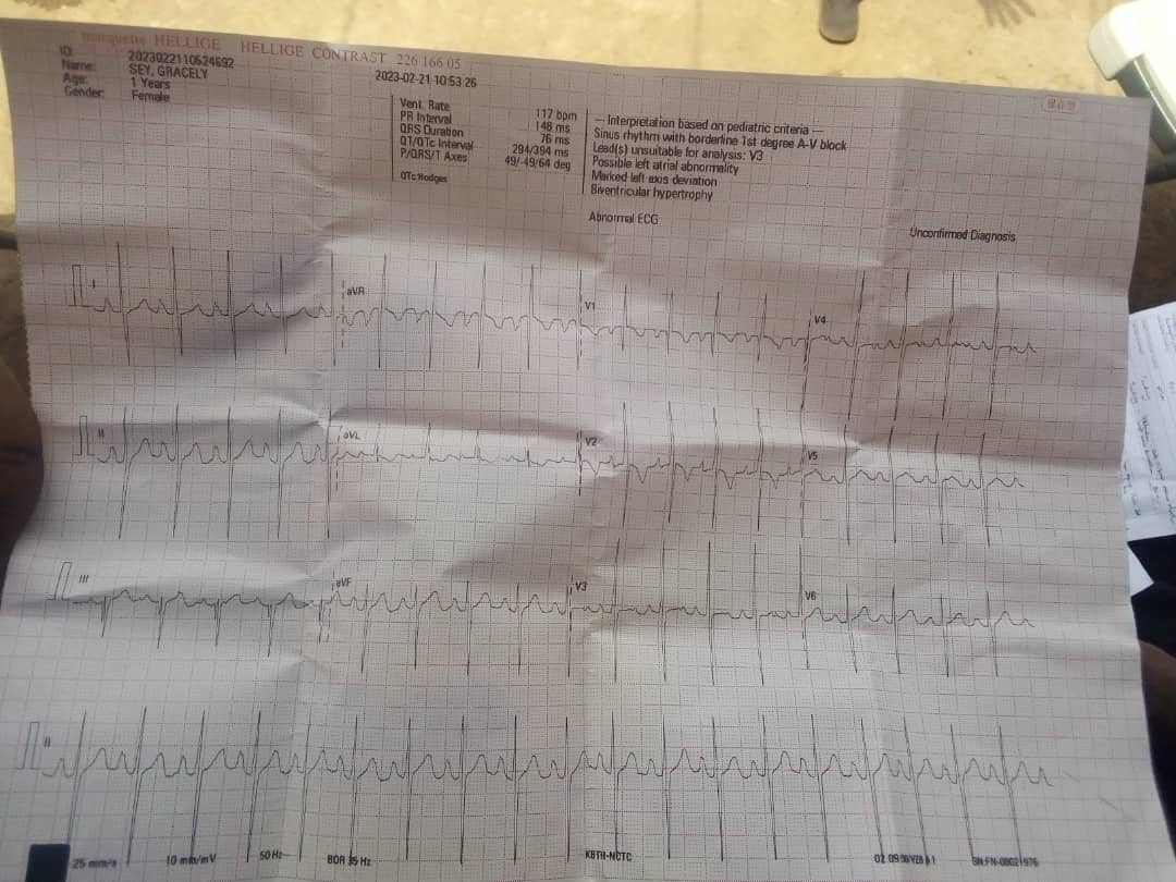KobbyKyei_'s tweet photo. HEALTH : Gracelyn Sey, a 2-year-old baby, is currently facing the challenge of a heart defect. Her family is in desperate need of immediate medical assistance. Through this message, I humbly appeal to organizations to extend their support to help this child. 1/2 https://t.co/H7iXRu1Jdg