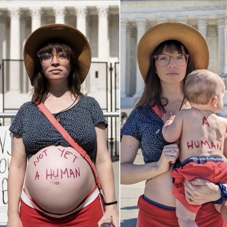 annamlulis's tweet photo. At conception: He was human, alive, &amp; had his entire genetic code determined.

In the first photo: He was human, had all organs present, could feel pain, &amp; could survive outside of the womb.

In the second photo: He's STILL a human. https://t.co/l5EFwb55x1