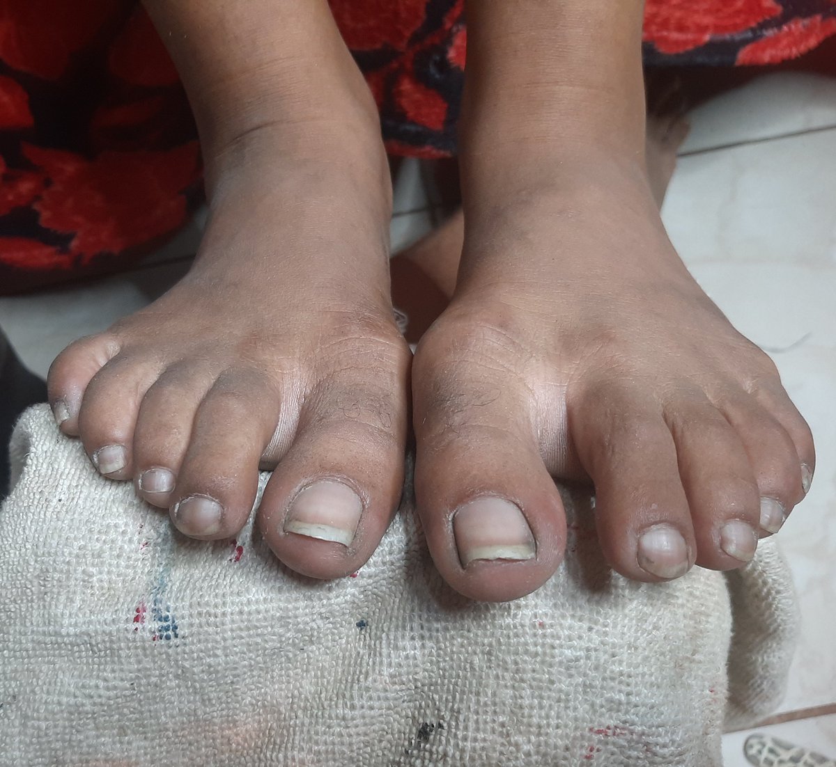 moreniintrem's tweet image. Antes/ Depois de respeito 🥰
#ClienteFeliz 🙌🏾❤