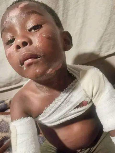 LeratoPillayZA's tweet photo. SADDEST STORY
Allegedly the kid on the picture - Unako Khala, from Langa township in Western Cape, was caught playing on the gate at a Makaluza home. Asanda Makaluza (frame 4) splashed BOILING WATER on the kid 😭😭😭
The family laid charges last week at Langa SAPS, up to now, the police never arrested Asanda.
 
RETWEET until Justice is served, please.
@AdvoBarryRoux
@MichaelBucwa
@akreana_
@kabelodick
@IsolezweNews
@eNCA

#powerup Keke Boksburg