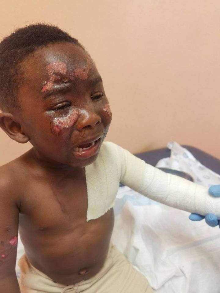 LeratoPillayZA's tweet photo. SADDEST STORY
Allegedly the kid on the picture - Unako Khala, from Langa township in Western Cape, was caught playing on the gate at a Makaluza home. Asanda Makaluza (frame 4) splashed BOILING WATER on the kid 😭😭😭
The family laid charges last week at Langa SAPS, up to now, the police never arrested Asanda.
 
RETWEET until Justice is served, please.
@AdvoBarryRoux
@MichaelBucwa
@akreana_
@kabelodick
@IsolezweNews
@eNCA

#powerup Keke Boksburg