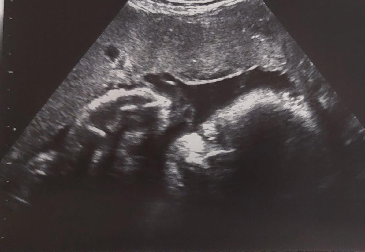 Today my maternity leave started! I will be offline to focus on welcoming another little boy🥰 See you back here in December!