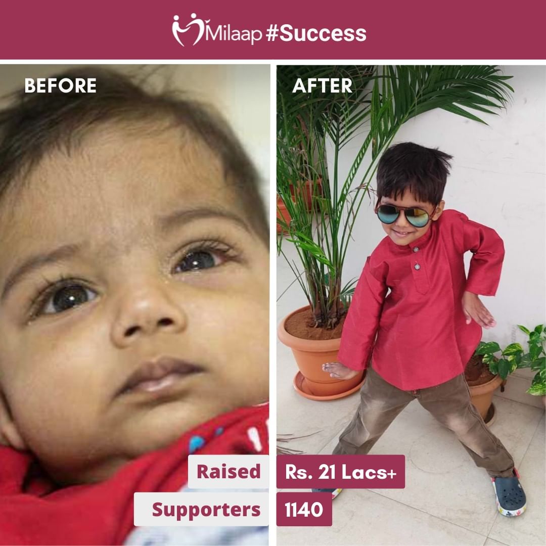 Celebrating a Miraculous Journey: Little Hero Defeats Liver Disease! This 6-month-old warrior conquered a severe liver disease, all thanks to the unwavering support of a loving donor community. 💚🙌 #TriumphOverAdversity #DonorCommunity
