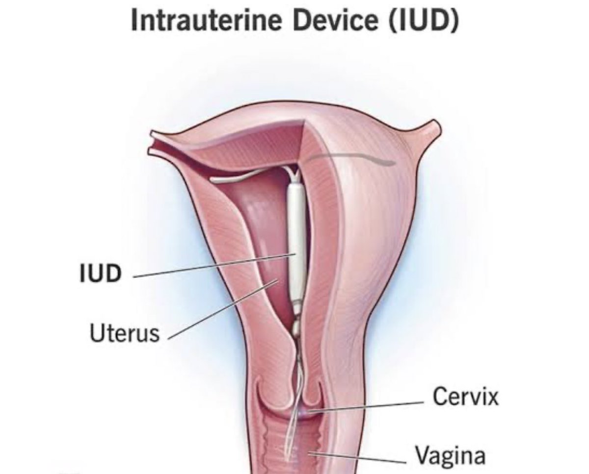 ZamakonkeK's tweet photo. Ladies! Let’s talk about family planning, which one doesn’t work or works best for you and why?

Condom, pill, IUD, injection, implant, hormonal ring, surgical sterilisation, abstaining, etc https://t.co/IuYNBkUjU4