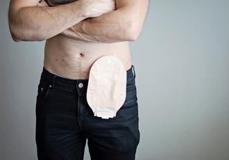 HkZuk's tweet photo. ⛔️ واحد عامل عمليه ومحتاج أكياس قولون colostomy bag فضل ليه واحد بس ياريت المساعده مكانه في شرق النيل ١٣ 
#حوجة_شرق_النيل | #حوجة_عاجلة https://t.co/dPFxts4bRB