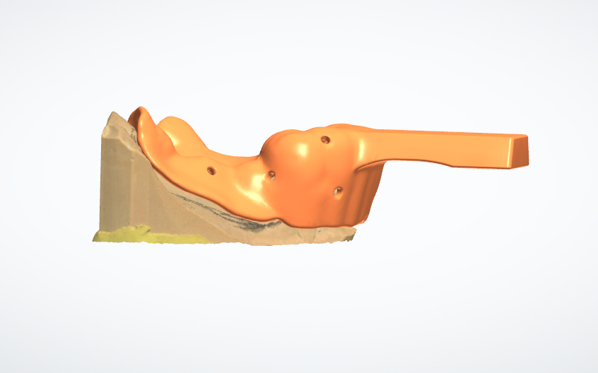 LabZdental33187's tweet image. Z lab  is full service Digital Dental  Design Outsourcing   center, we have 20+ designers, welcome to outsource your design work from us. With fast turnaround time (2 Hours/8 Hours) and competitive price.
#Dental #Zlab #dentaldesign #smiledesign #partialdesign