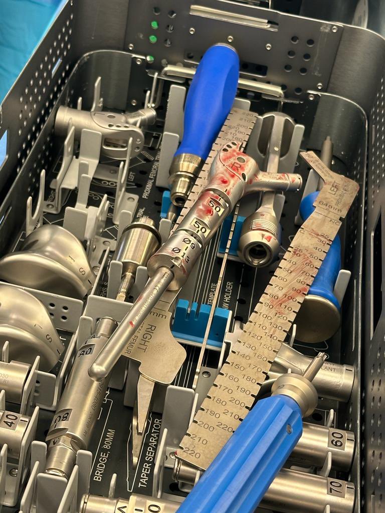 uocuk2's tweet photo. It’s been another busy day for the United Orthopedic UK team at the Royal Hampshire County Hospital ssisting Mr Jamie Griffiths and Mr Geoffrey Stranks with the USTAR II Proximal Femoral Replacement. #orthotwitter  #USTARII #medtwitter #medicaldevices https://t.co/jWlXsku3gD