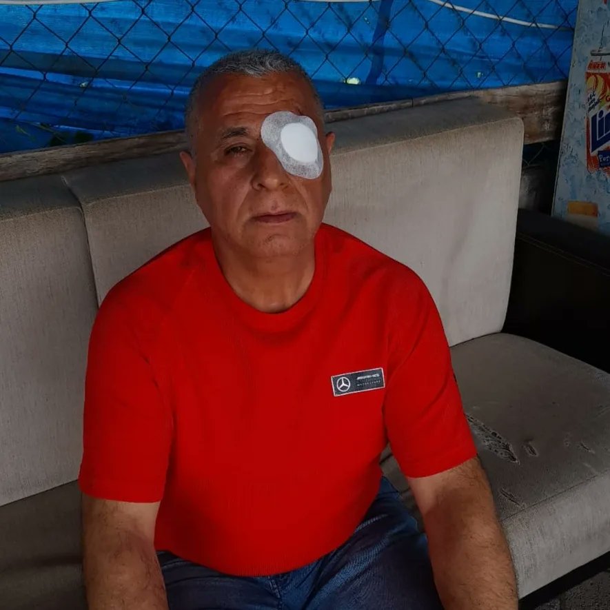 AdilTOPUZ7's tweet photo. 06.07.2023 sabah Mersin şehir hastanesi’nde ikinci gözümden amaliyat oldum. Uzm. Dr. Fırat Selen ve ekibine çok teşekkür ediyorum. Ayrıca amaliyat boyunca beni yanlız birakmayan Sait bey'e teşekkür ederim. Rabbim tüm hastalara acil şifalar versin. https://t.co/rRQpKERJne