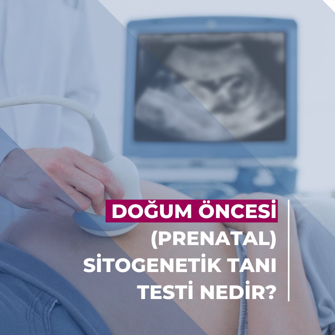 NextGenCen's tweet photo. Doğum öncesi sitogenetikanaliz, prenatal tanı endikasyonu olan hastalarda uygulanan tanısal bir testtir.

#NextGeneticCenter #Sitogenetik #pretanal #genetik #İstanbul #sağlık https://t.co/IJI1r5yQi6