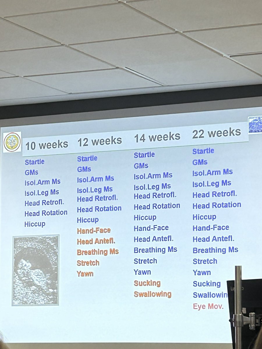 Great week doing the Prechtl GM assessment course! 👶🏻 <a href="/uclh/">UCLH</a> <a href="/EI_Smart/">Ei SMART</a> <a href="/Bettyhutchon/">COACHTY</a>