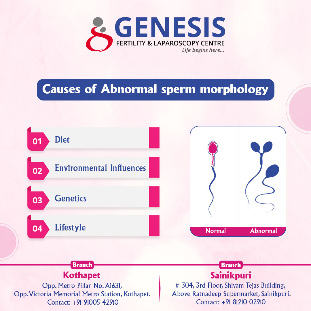 Abnormal sperm morphology refers to sperm with atypical shapes or structural abnormalities, which can affect fertility. #spermcount #Abnormalsperm #fertility #sperm #infertility #maleinfertility #malefertility #fertilityjourney #Genesisfertilitycentre