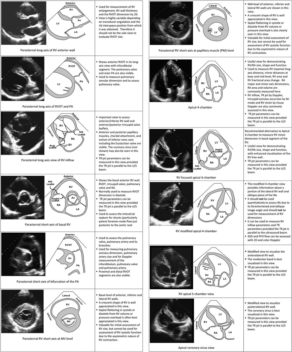 #echofirst views used to perform comprehensive evaluation of the right heart. Each view is accompanied by uses, advantages, and limitations.

Courtesy: ……s-jbs-prod-cdn.jbs.elsevierhealth.com/cms/attachment……

#POCUS #MedEd #Nephpearls #IMPOCUS
