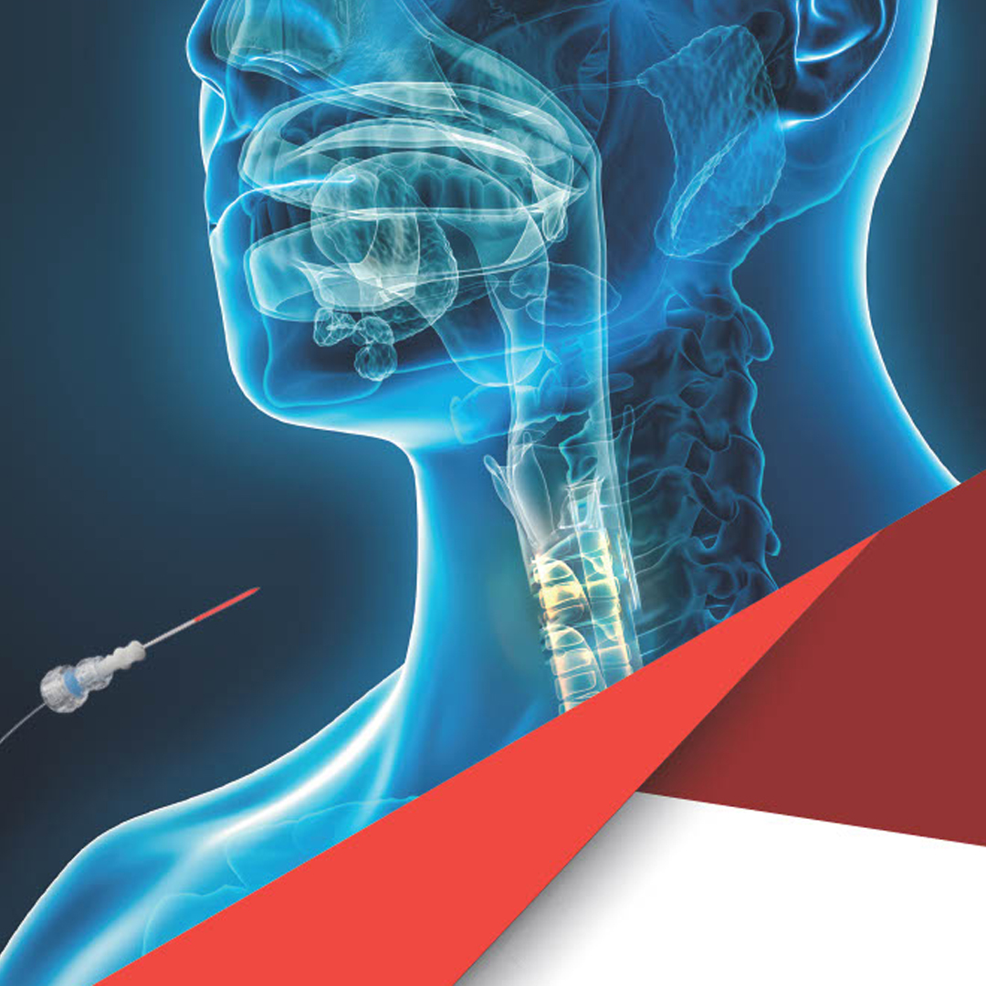 IPA2023's tweet photo. 🎉 Exciting news! We're thrilled to have Medlight as a Gold Sponsor for #ipa2023 Congress! Their invaluable support is driving advancements in photodynamic therapy and diagnostics. Thank you for being part of this incredible event! #Medlight #photodynamictherapy #diagnostics https://t.co/sMDIPpw6km