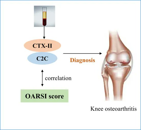 FEBSOpenBio's tweet photo. Combined detection of serum CTX-II and C2C in a rat model of ACLT-induced osteoarthritis
▶️https://t.co/B7yRUUKNY5
#Osteoarthritis #TypeIICollagen
#Biomarkers #ExtracellularMatrix https://t.co/IcH3yVqAll