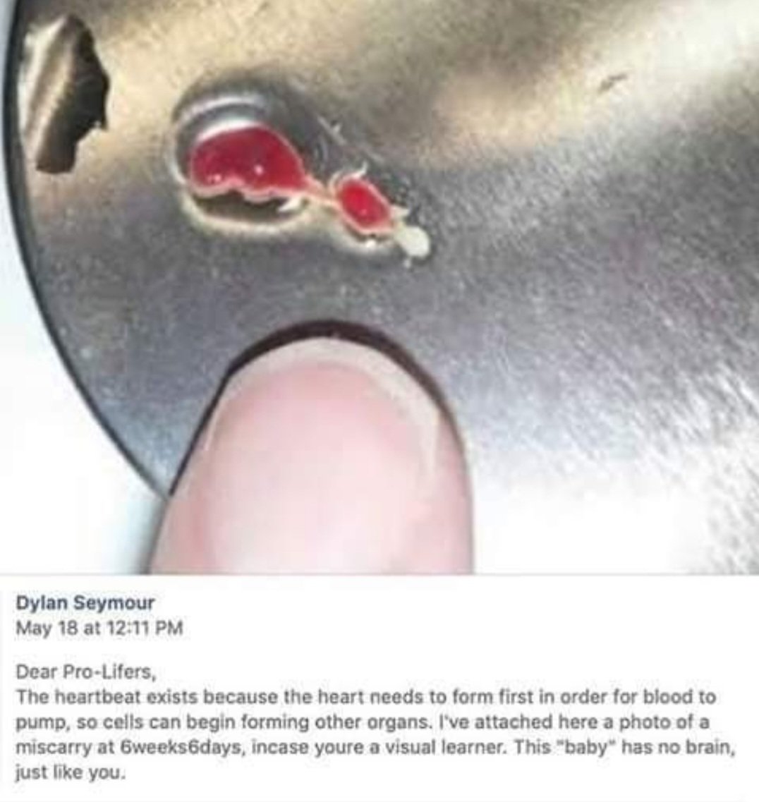 🇺🇦🇺🇸Lisa Nichols @Lisa'sAlright tweet media