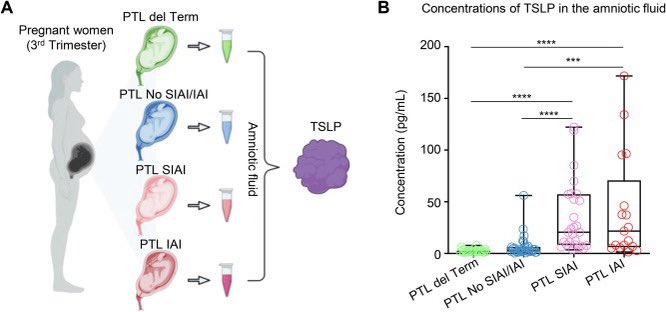 nardhygomez's tweet photo. TSLP: Insights into the host response against microbial invasion in the amniotic cavity during preterm labor. Check out @KanninenTomi’s MFM thesis! 👏🔬 #PretermLabor #Maternal #Fetal #Immunity: https://t.co/vxfAwJX8re  #PRB #NGLLab @KevinRTheis’s lab @DMC_Heals @waynemedicine https://t.co/mue2olHKs4