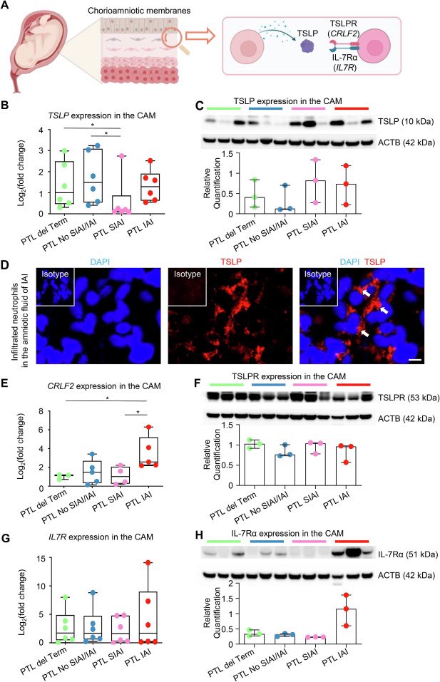 nardhygomez's tweet photo. TSLP: Insights into the host response against microbial invasion in the amniotic cavity during preterm labor. Check out @KanninenTomi’s MFM thesis! 👏🔬 #PretermLabor #Maternal #Fetal #Immunity: https://t.co/vxfAwJX8re  #PRB #NGLLab @KevinRTheis’s lab @DMC_Heals @waynemedicine https://t.co/mue2olHKs4